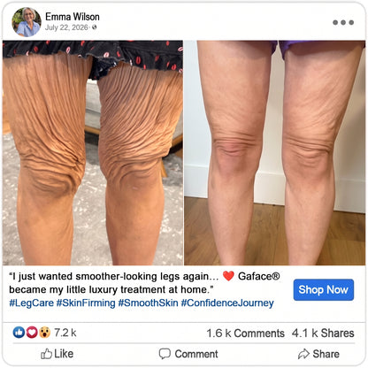 𝗚𝗮𝒇𝒂𝒄𝒆® 𝗣𝗗𝑹𝑵 𝗔𝗻𝘁𝗶‑𝑨𝒈𝒆𝒊𝒏𝒈 𝗣𝗲𝗽𝒕𝒊𝒅𝒆 𝗥𝗲𝗻𝗲𝘄𝒂𝒍 𝗦𝘁𝗶𝗰𝗸
