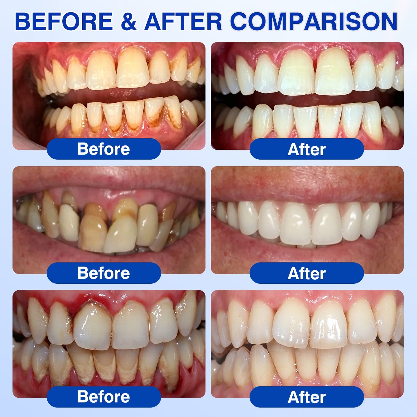uk🏅🦷🛡️𝐄𝐯𝐨𝐥𝐯𝐢𝐨𝐧® GumRevive Periodontal Repair Gel
