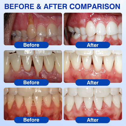 uk🏅🦷🛡️𝐄𝐯𝐨𝐥𝐯𝐢𝐨𝐧® GumRevive Periodontal Repair Gel