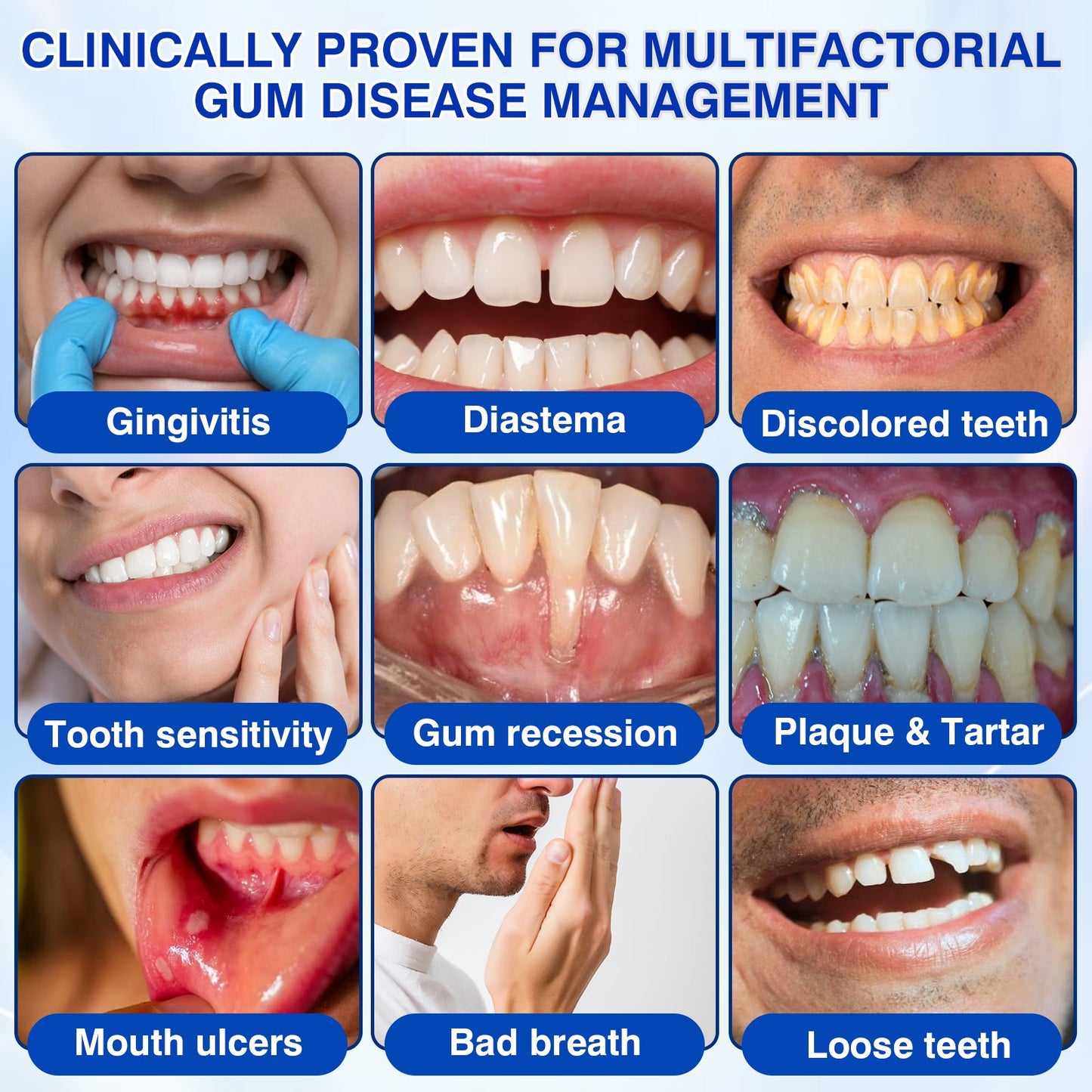 uk🏅🦷🛡️𝐄𝐯𝐨𝐥𝐯𝐢𝐨𝐧® GumRevive Periodontal Repair Gel