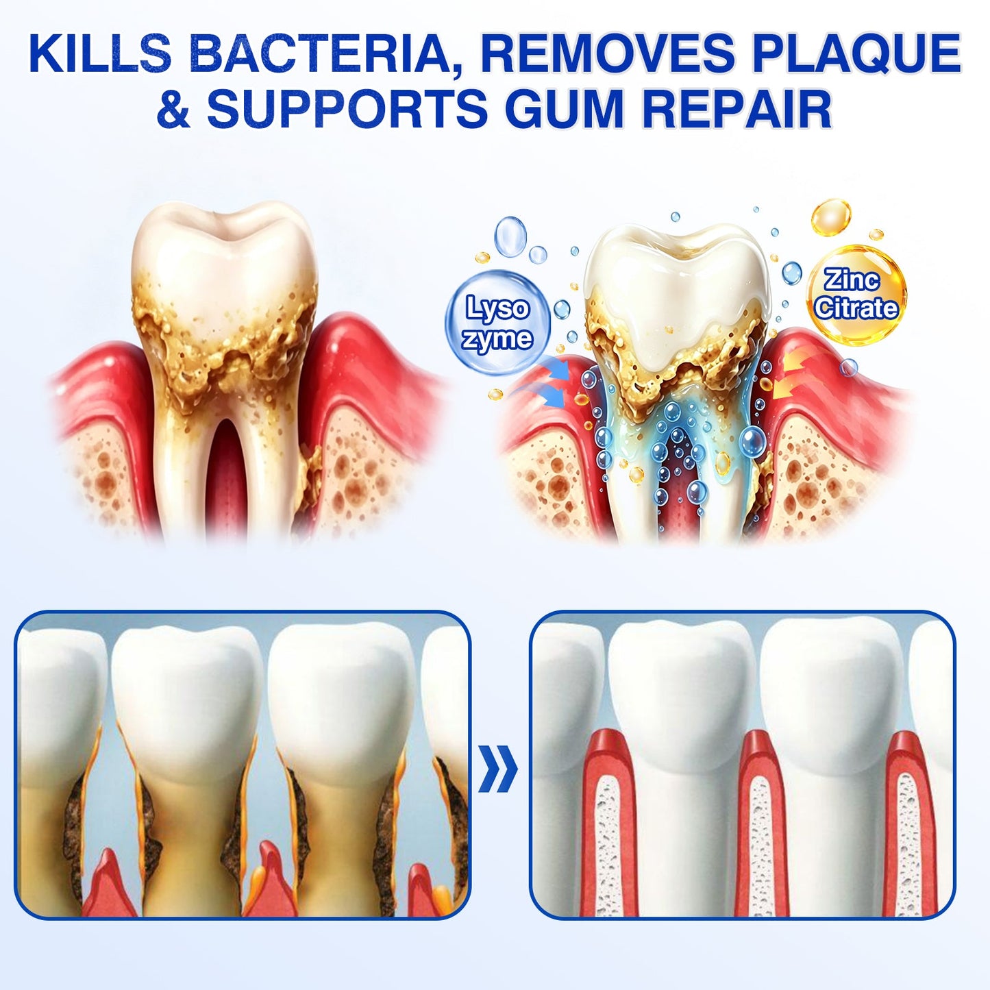 uk🏅🦷🛡️𝐄𝐯𝐨𝐥𝐯𝐢𝐨𝐧® GumRevive Periodontal Repair Gel