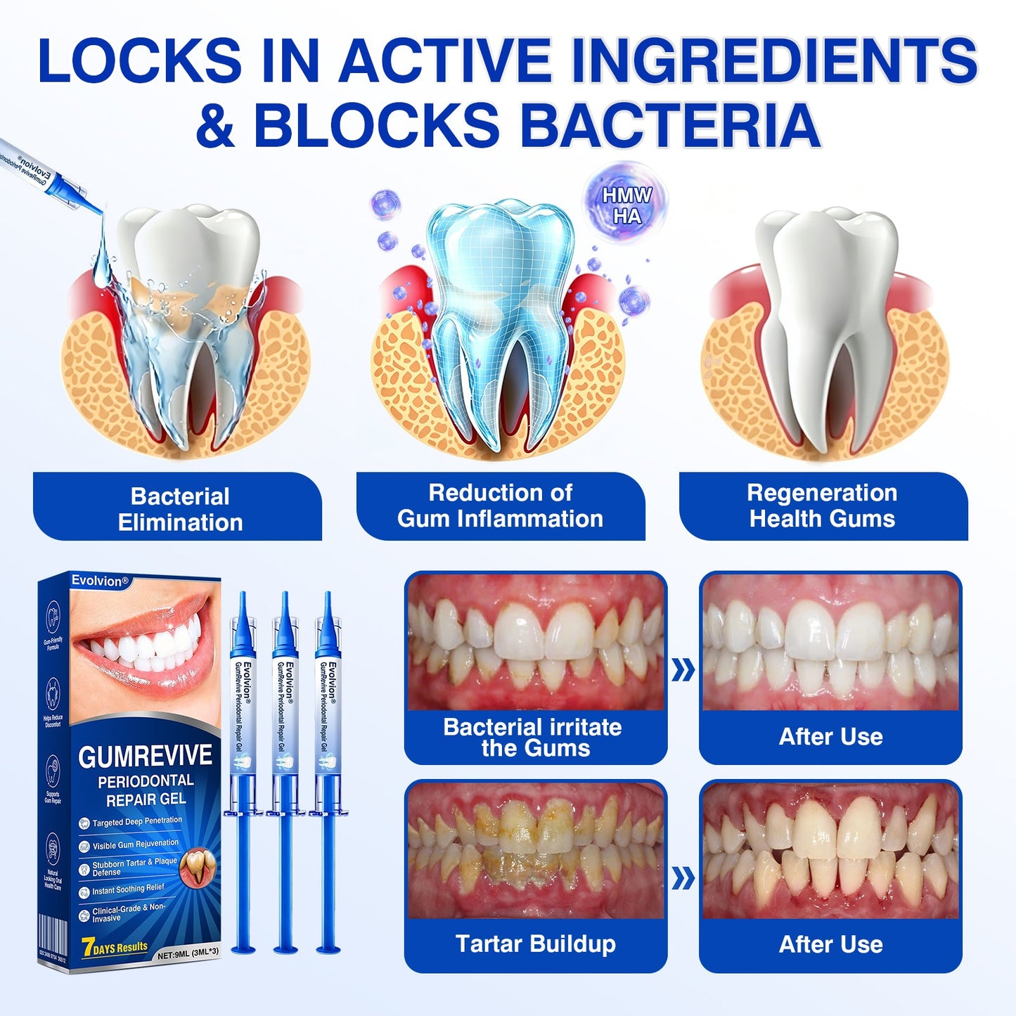 uk🏅🦷🛡️𝐄𝐯𝐨𝐥𝐯𝐢𝐨𝐧® GumRevive Periodontal Repair Gel