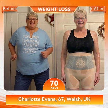 𝗣𝗔𝗨𝗥𝗔𝑱𝑼® 𝗠𝗼𝗿𝗶𝗻𝗴𝒂 & 𝗕𝗲𝗿𝗯𝗲𝗿𝗶𝗻𝒆 𝟰-𝗶𝗻-𝟭 𝗠𝗶𝗰𝗿𝒐-𝗣𝗮𝗿𝘁𝗶𝗰𝗹𝗲 𝗦𝗰𝘂𝗹𝗽𝘁𝗶𝗻𝗴 & 𝗙𝗮𝘁-𝑩𝒖𝒓𝒏 𝗦𝗵𝗼𝗿𝘁𝘀 ⚡ 𝗙𝗶𝗿𝗺 & 𝗦𝗵𝗮𝗽𝗲 𝗶𝗻 𝗝𝘂𝘀𝘁 𝟯𝟬 𝗠𝗶𝗻𝘂𝘁𝗲𝘀 ✨ 𝟮𝟬𝟮𝟲 𝗟𝗮𝘁𝗲𝘀𝘁 𝗠𝗼𝗱𝗲𝗹
